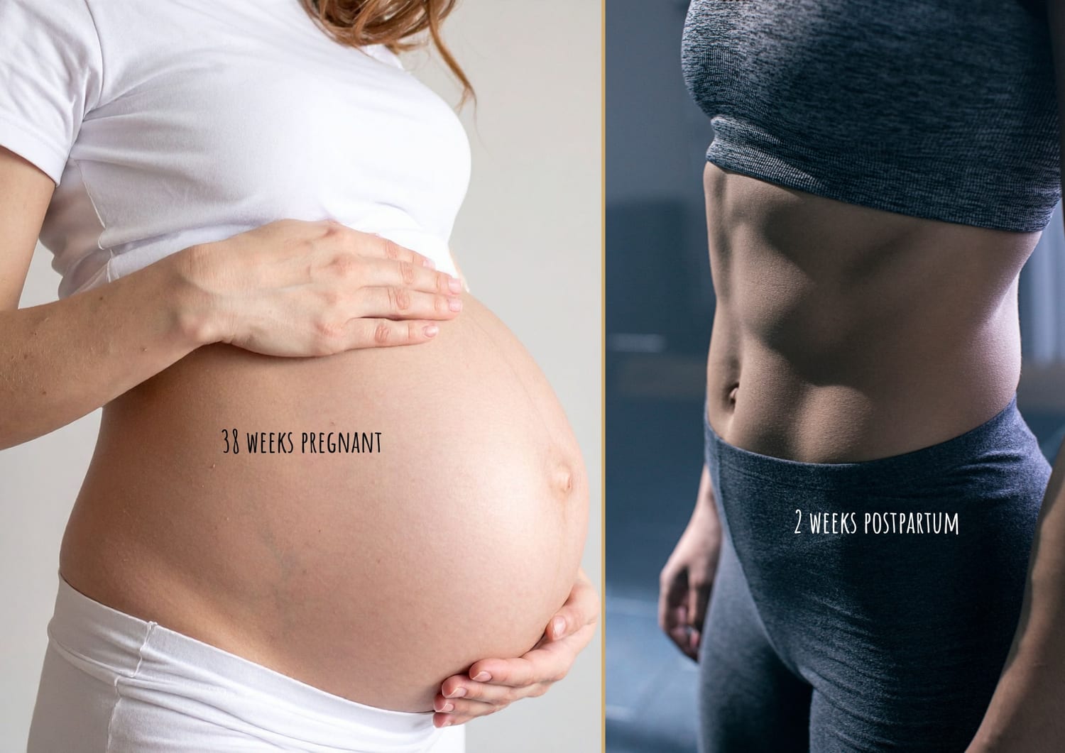 Social media's unrealistic portrayal of "bouncing back" after pregnancy.